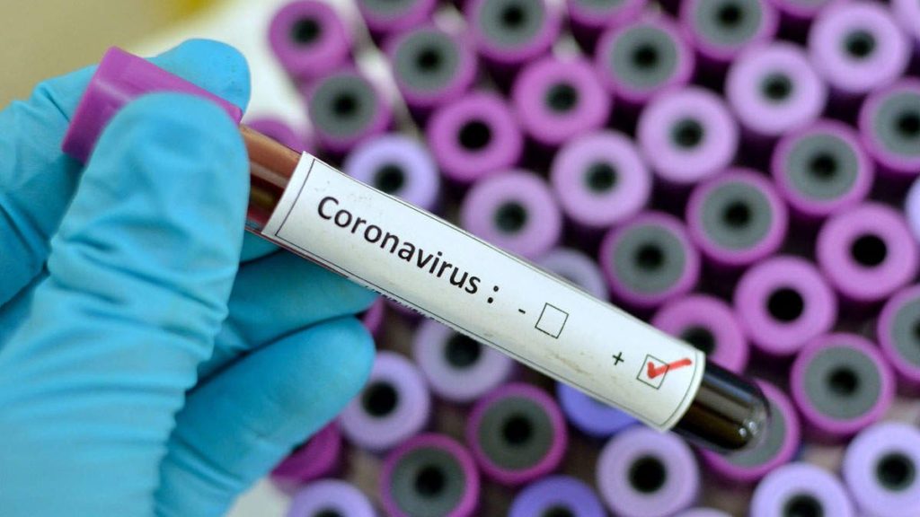 spesimen coronavirus